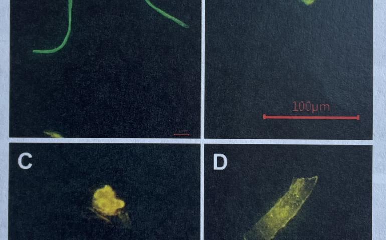 Magnified 400 times, four types of microplastics found by Subhabrata Dev, Srijan Aggarwal, and others during a study in Alaska. A is a plastic fiber, B a fragment, C a pellet, and D a film. From the paper Unveiling Microplastics Pollution in Alaskan Waters and Snow.